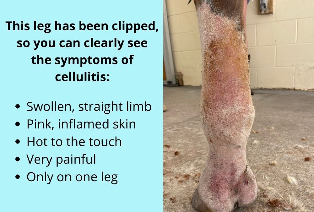 Cellulitis and Legs