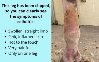 Cellulitis and Legs